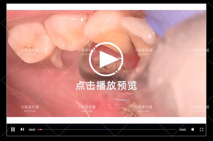 生活解压纪录片清洗牙结石全1季中视频自媒体解说高清视频素材