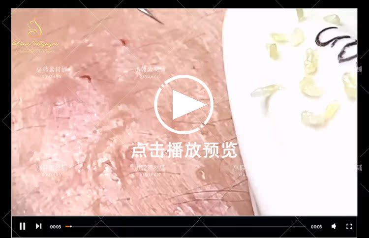 健康解压纪录片祛黑痘全1季中视频自媒体解说高清剪辑视频素材
