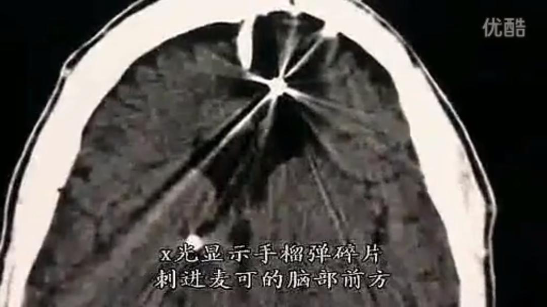 人脑漫游 Brain Story