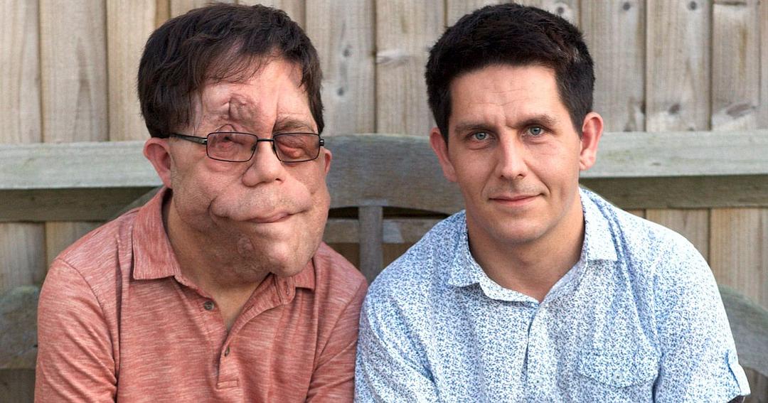 地平线系列：我的神奇双胞胎 Horizon: My Amazing Twin