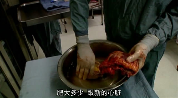 超级新人类 Superhuman