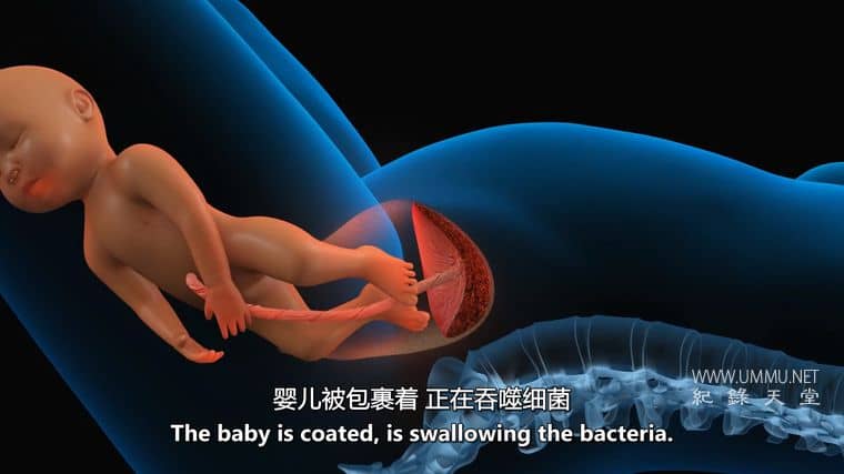 微分娩 Microbirth