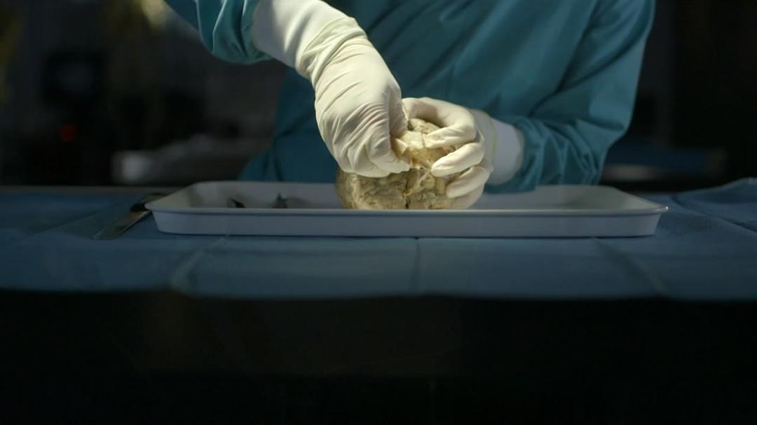 是什么让人类如此不同 What Makes Us Human