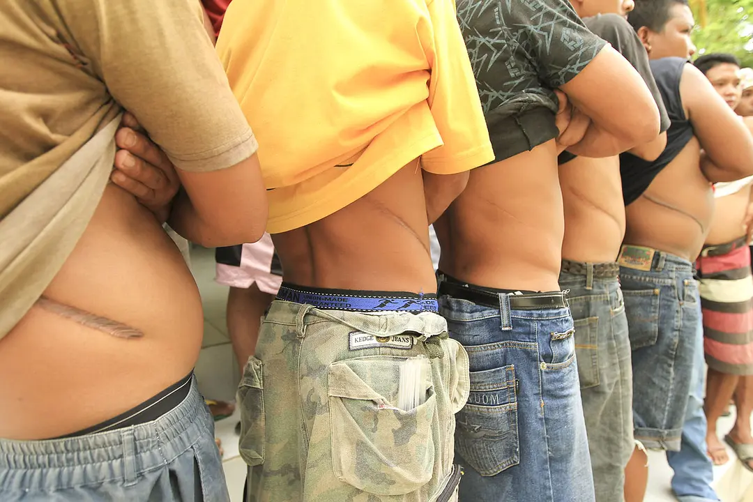 人体器官交易实录 Tales from the Organ Trade