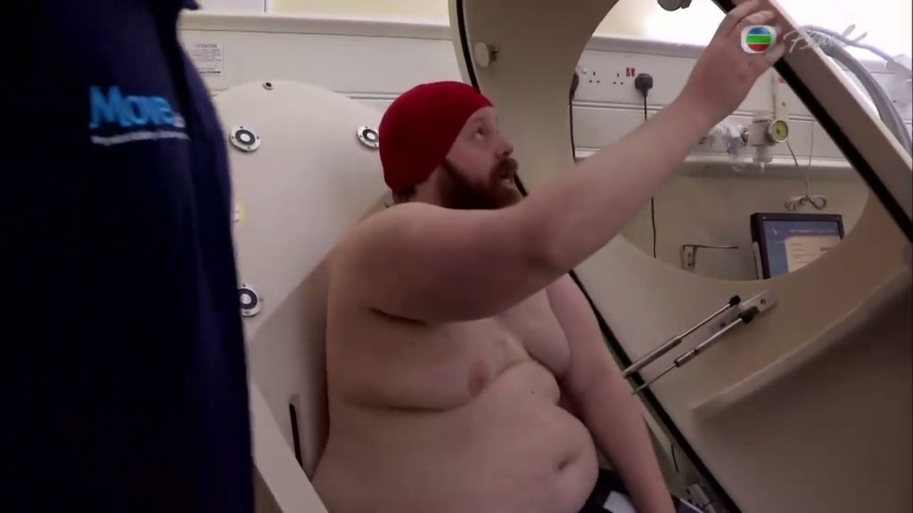 糖的真相 The Truth About Sugar