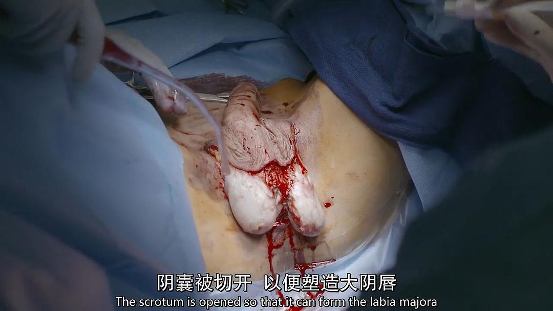 地平线系列：跨性别者 Horizon: Being Transgender