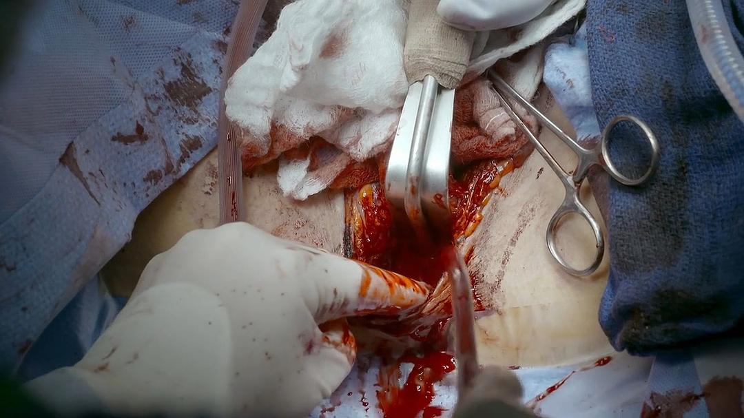 地平线系列：跨性别者 Horizon: Being Transgender