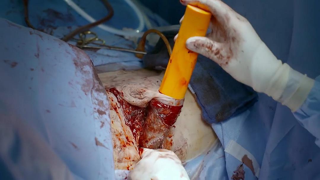 地平线系列：跨性别者 Horizon: Being Transgender