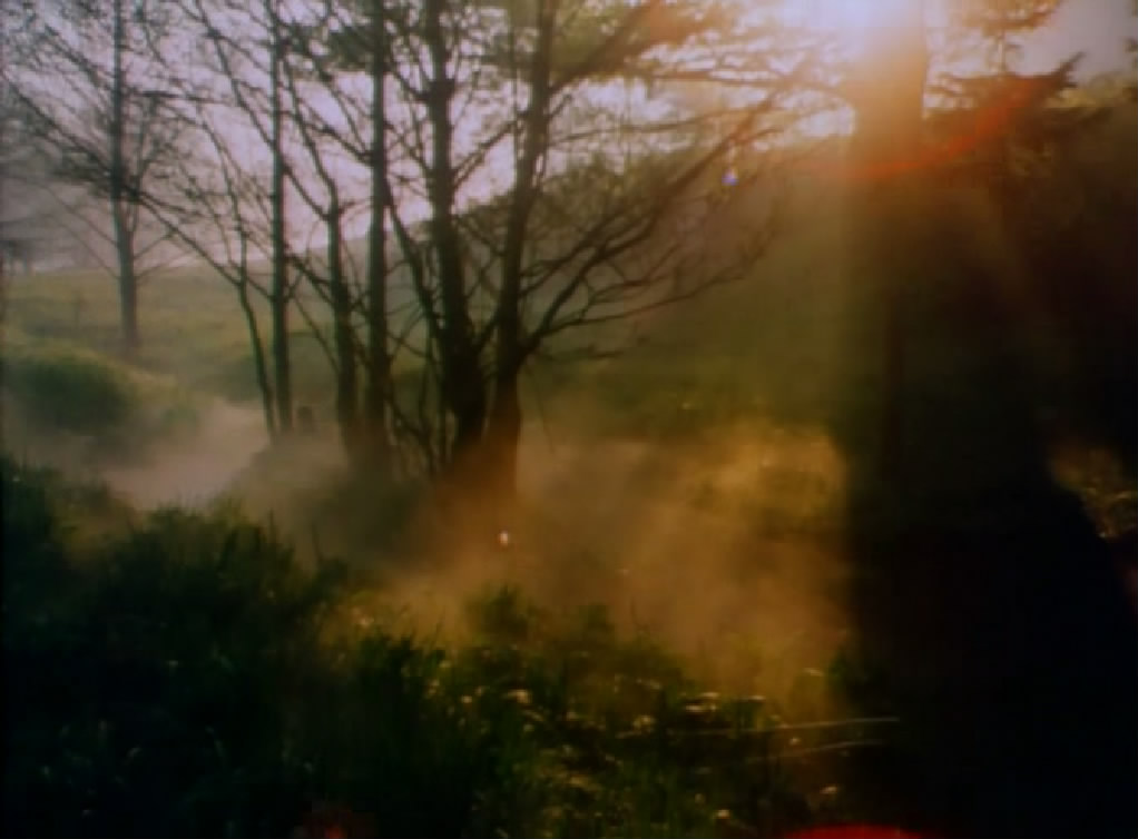 X射线 Prześwietlenie