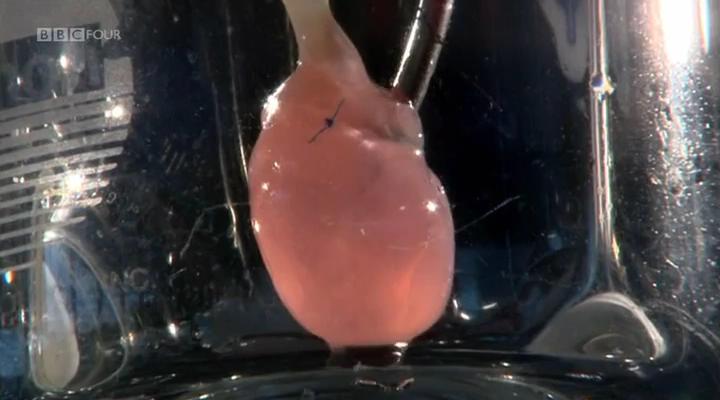 移植指南 Mend Me: A Horizon Guide to Transplants