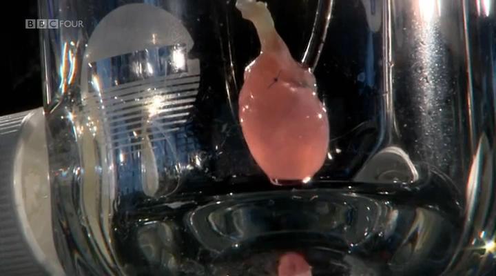 移植指南 Mend Me: A Horizon Guide to Transplants