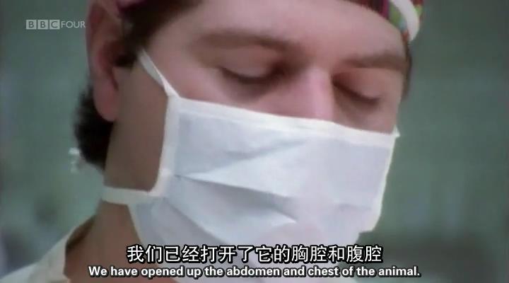 移植指南 Mend Me: A Horizon Guide to Transplants