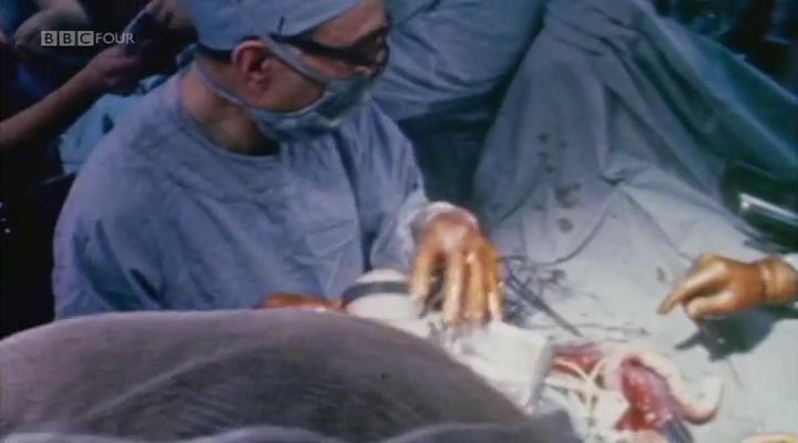 移植指南 Mend Me: A Horizon Guide to Transplants