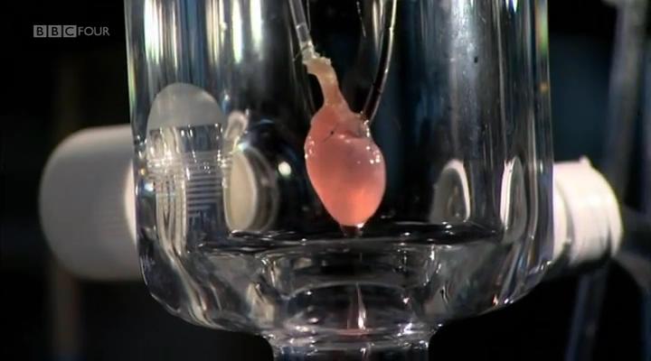 移植指南 Mend Me: A Horizon Guide to Transplants