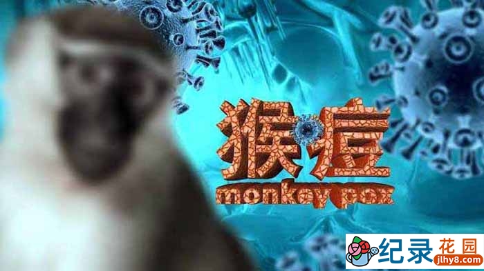 防疫纪录片《猴痘来袭》全1集中字 720P纪录片资源百度云盘下载