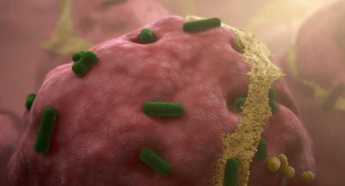 人体上的生命 Life On Us