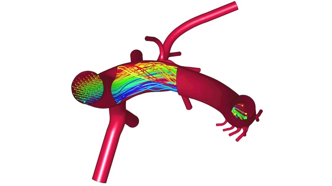 探索血液 The Wonderful World of Blood with Michael Mosley