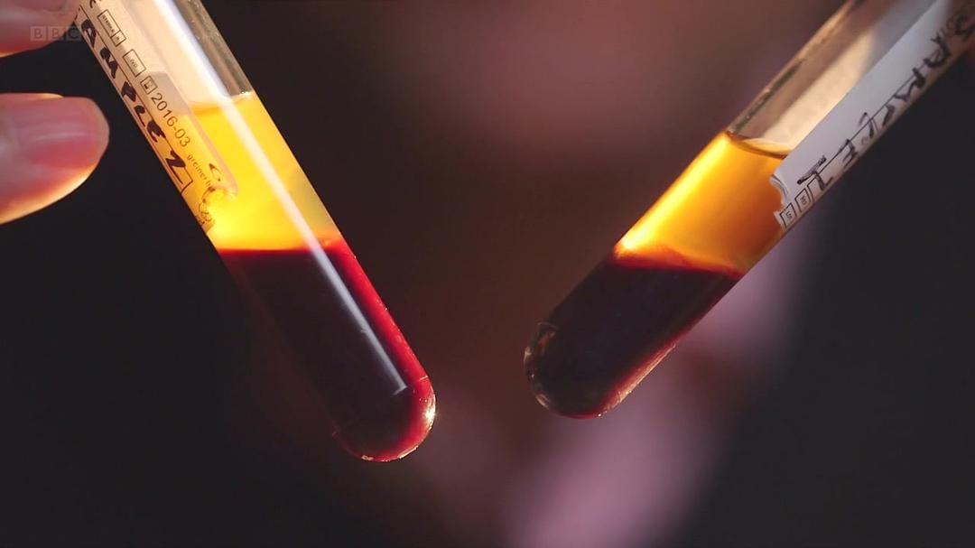 探索血液 The Wonderful World of Blood with Michael Mosley