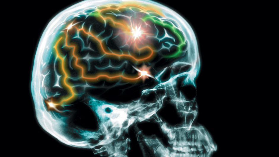 脑力大挑战 Test Your Brain