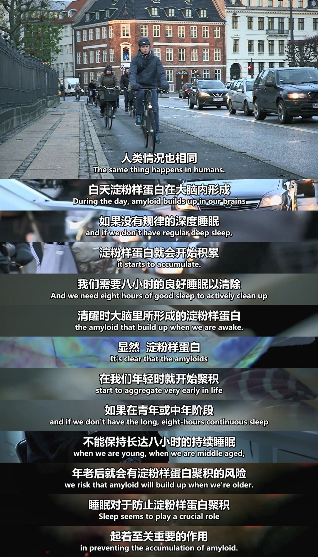 地平线系列：治愈阿尔茨海默病 Horizon: Curing Alzheimer's