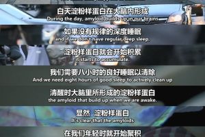 地平线系列：治愈阿尔茨海默病 Horizon: Curing Alzheimer's