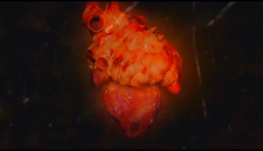 狗心 Heart of a Dog