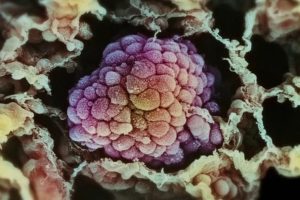 癌症：众疾之皇 Cancer: The Emperor of All Maladies