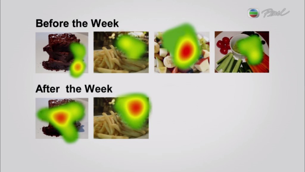 肥胖的真相 The Truth about Fat