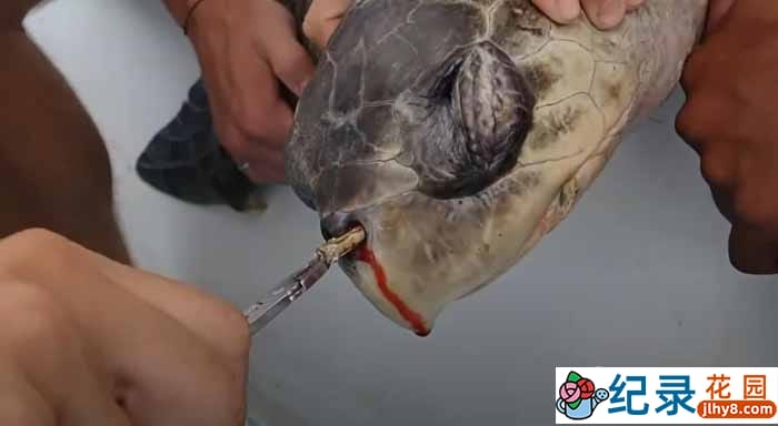 动物保护纪录片《拯救海龟：鼻腔拔出吸管》全1集中字（8Min完整对白）720P/1080i高清纪录片资源百度云盘下载