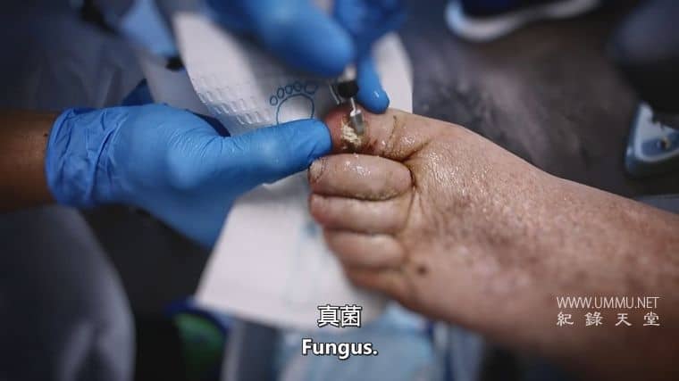 脚趾兄弟 The Toe Bro