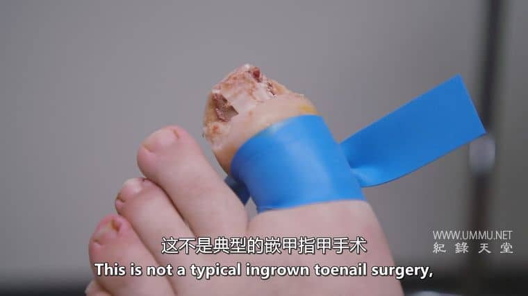 脚趾兄弟 The Toe Bro