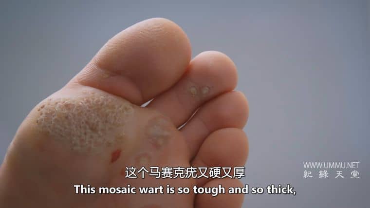 脚趾兄弟 The Toe Bro