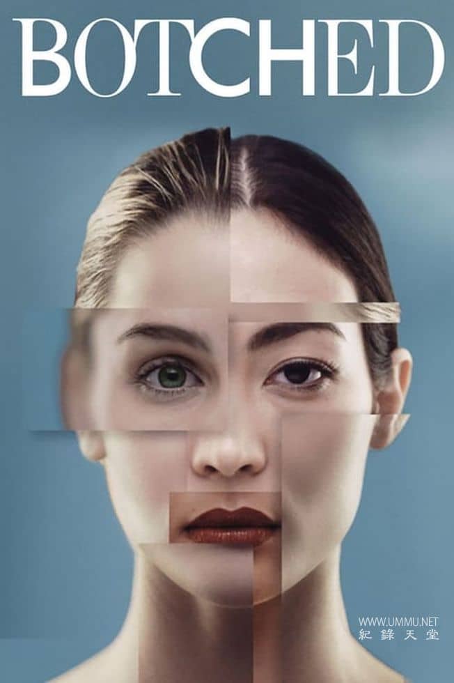 拯救失败整形术 Botched