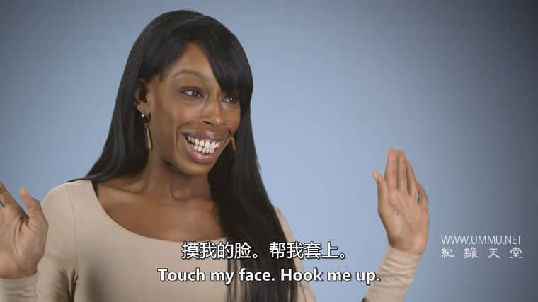 拯救失败整形术 Botched