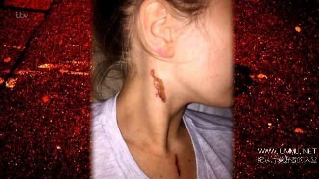 英国泼酸袭击 Acid Attacks How Scared Should We Be