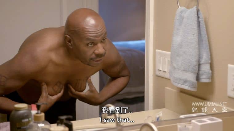 清醒手术 Awake Surgery