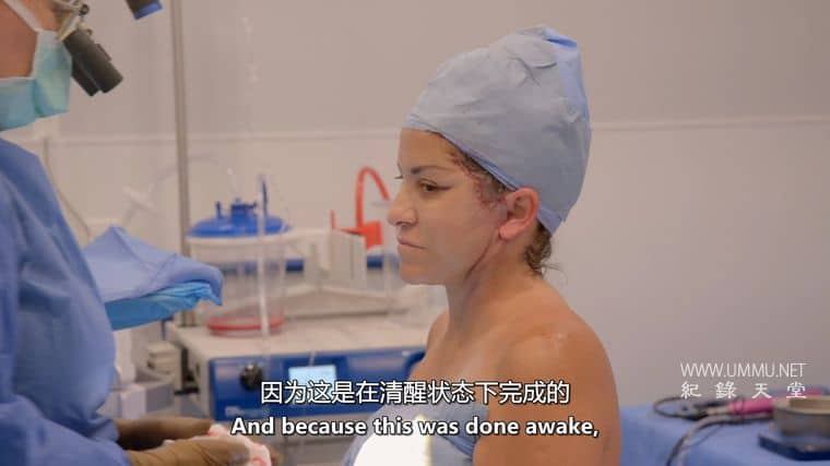 清醒手术 Awake Surgery