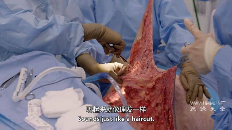 清醒手术 Awake Surgery