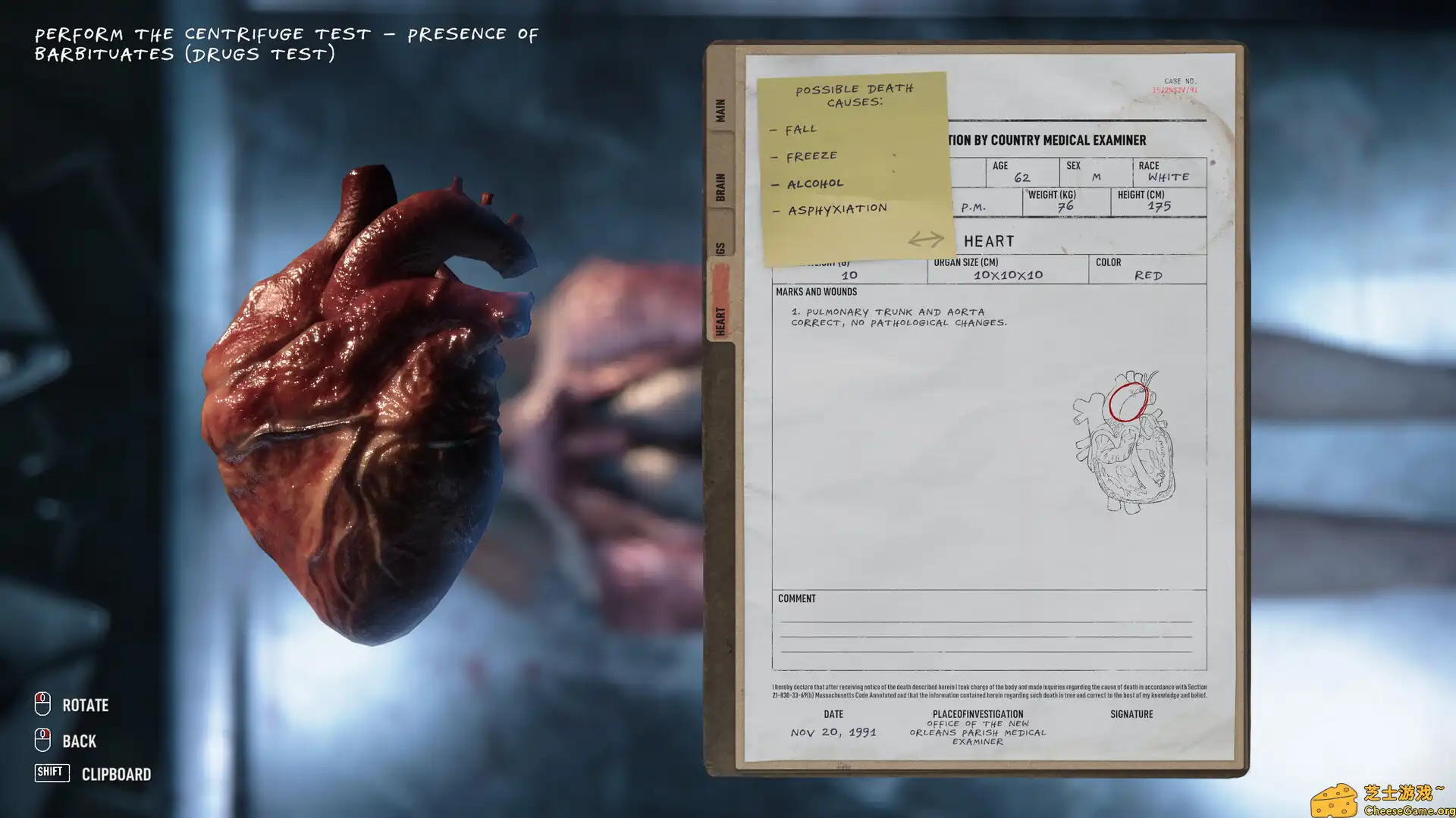 [PC]验尸模拟器/Autopsy Simulator