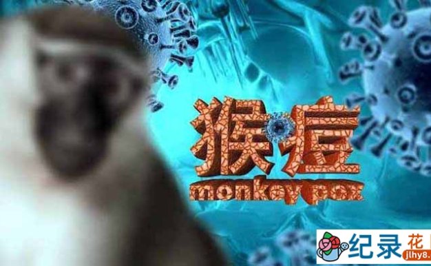 防疫纪录片《猴痘来袭》全1集中字 720P纪录片资源百度云盘下载